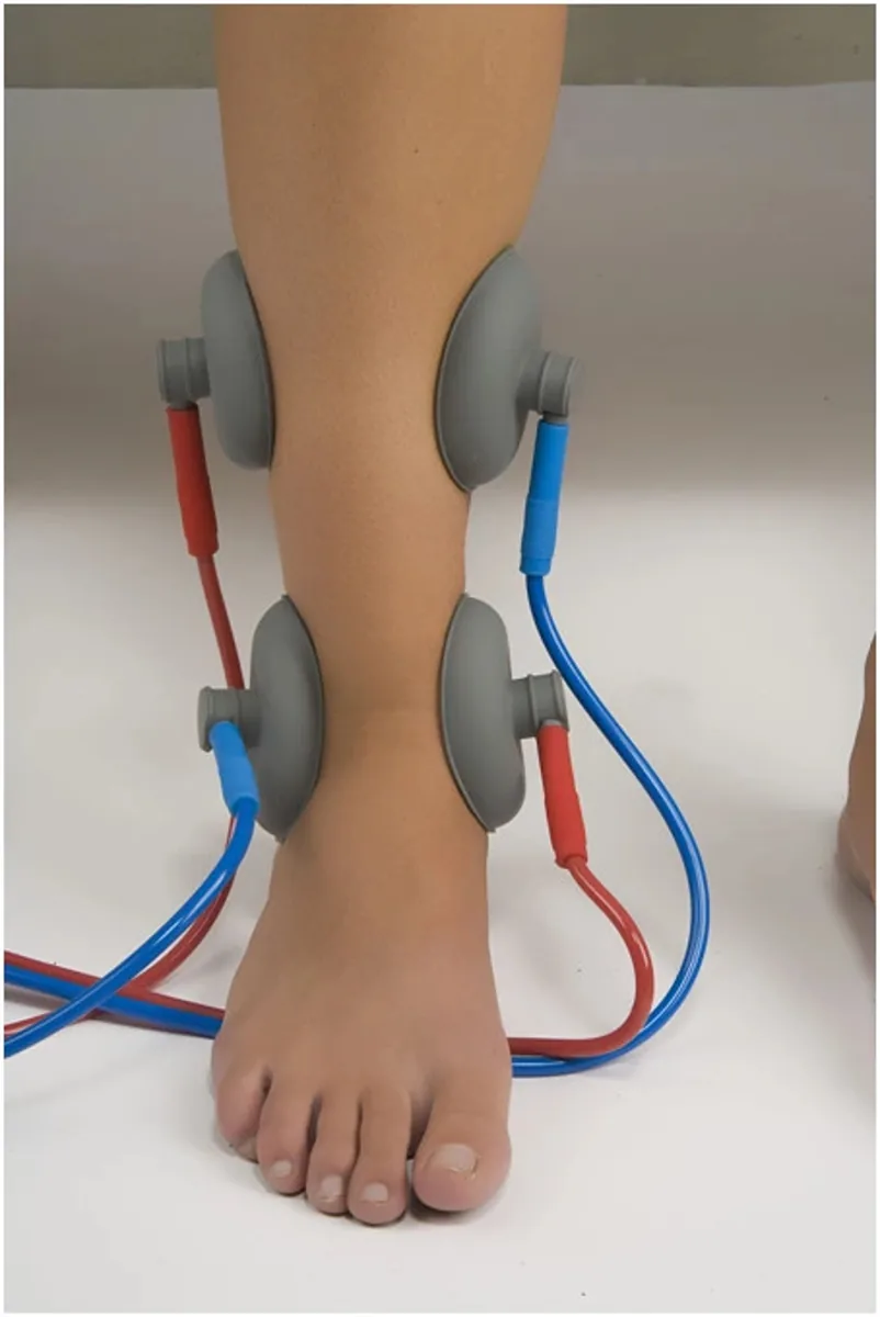 Neuromed electroanalgesia suction-cup electrodes placed on a lower leg and ankle.